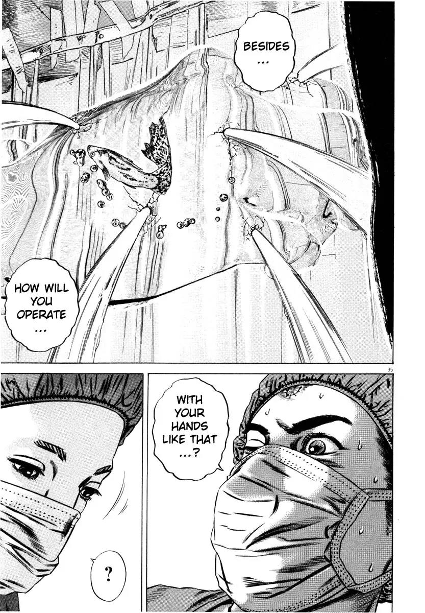 Homunculus chapter 30 page 38