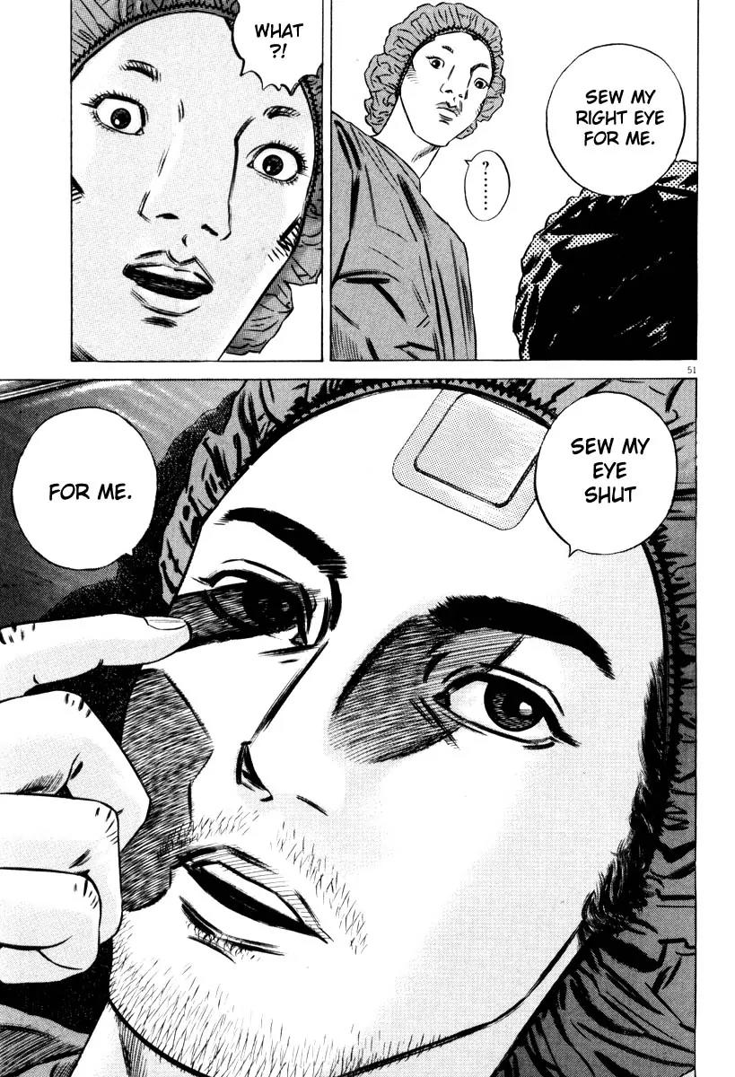 Homunculus chapter 31 page 1